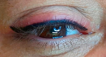 Micro pigmentación de ojos