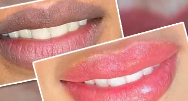 Neutralización del tono labial