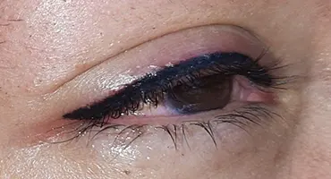 Micropigmentación de ojos
